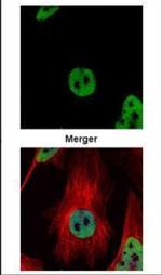 HDAC2 Antibody in Immunocytochemistry (ICC/IF)