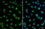 HDAC2 Antibody in Immunocytochemistry (ICC/IF)