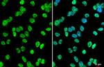 HDAC2 Antibody in Immunocytochemistry (ICC/IF)