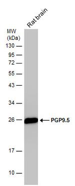 PGP9.5 Antibody in Western Blot (WB)