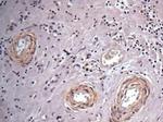 Vinculin Antibody in Immunohistochemistry (Paraffin) (IHC (P))