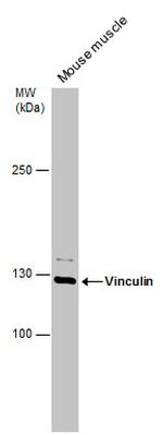 Vinculin Antibody in Western Blot (WB)