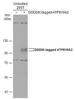 ATP6V0A2 Antibody in Western Blot (WB)