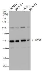 SERPINA3 Antibody in Western Blot (WB)