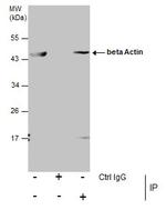 beta Actin Antibody in Immunoprecipitation (IP)