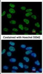 STAT3 Antibody in Immunocytochemistry (ICC/IF)