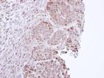 STAT3 Antibody in Immunohistochemistry (Paraffin) (IHC (P))