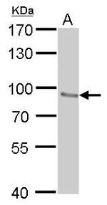 STAT3 Antibody in Western Blot (WB)