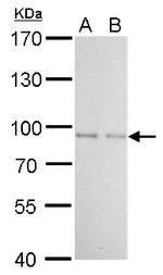 FOXO1 Antibody in Western Blot (WB)