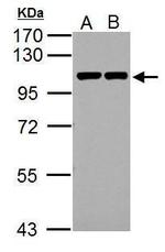 Catenin alpha-1 Antibody in Western Blot (WB)