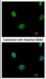 ATM Antibody in Immunocytochemistry (ICC/IF)