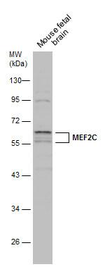 Phospho-MEF2C (Thr20) Antibody in Western Blot (WB)