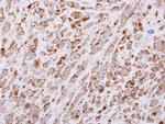 EGF Antibody in Immunohistochemistry (Paraffin) (IHC (P))