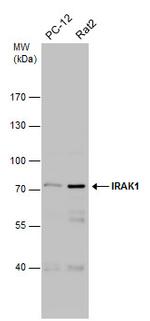 IRAK1 Antibody in Western Blot (WB)