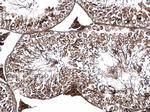 PSKH1 Antibody in Immunohistochemistry (Paraffin) (IHC (P))