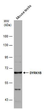 DYRK1B Antibody in Western Blot (WB)