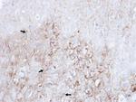 LAMP2 Antibody in Immunohistochemistry (Paraffin) (IHC (P))