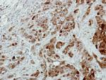 PRDX3 Antibody in Immunohistochemistry (Paraffin) (IHC (P))