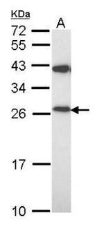 PRDX3 Antibody in Western Blot (WB)