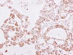 PRDX3 Antibody in Immunohistochemistry (Paraffin) (IHC (P))