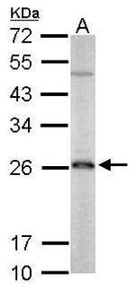 PRDX3 Antibody in Western Blot (WB)