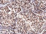 NPM1 Antibody in Immunohistochemistry (Paraffin) (IHC (P))