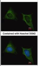 beta Tubulin Antibody in Immunocytochemistry (ICC/IF)