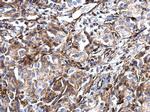 Vimentin Antibody in Immunohistochemistry (Paraffin) (IHC (P))