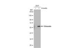 Vimentin Antibody in Western Blot (WB)