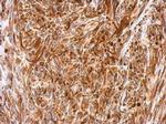 Vimentin Antibody in Immunohistochemistry (Paraffin) (IHC (P))