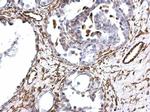 Vimentin Antibody in Immunohistochemistry (Paraffin) (IHC (P))