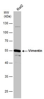 Vimentin Antibody in Western Blot (WB)