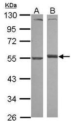 alpha-1 Antitrypsin Antibody in Western Blot (WB)