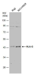 HLA-G Antibody in Western Blot (WB)