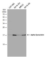 alpha Synuclein Antibody in Western Blot (WB)