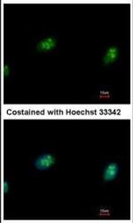 CDK4 Antibody in Immunocytochemistry (ICC/IF)