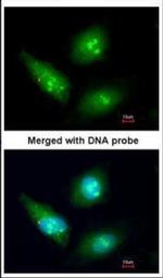 CDK4 Antibody in Immunocytochemistry (ICC/IF)