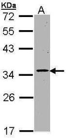 CDK4 Antibody in Western Blot (WB)