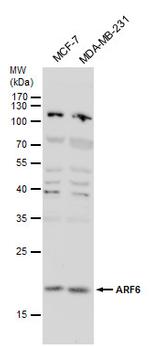 ARF6 Antibody in Western Blot (WB)