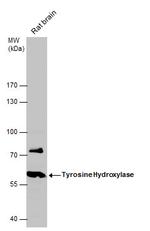 Tyrosine Hydroxylase Antibody in Western Blot (WB)