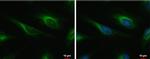 Cardiac Troponin I Antibody in Immunocytochemistry (ICC/IF)