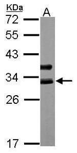 Cardiac Troponin I Antibody in Western Blot (WB)