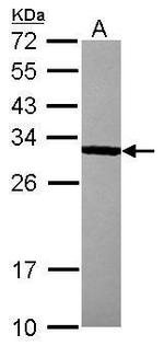 Bcl-10 Antibody in Western Blot (WB)