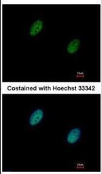 CHK2 Antibody in Immunocytochemistry (ICC/IF)