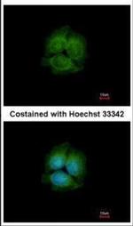 LRRK2 Antibody in Immunocytochemistry (ICC/IF)