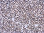 LRRK2 Antibody in Immunohistochemistry (Paraffin) (IHC (P))