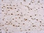 HDAC2 Antibody in Immunohistochemistry (Paraffin) (IHC (P))