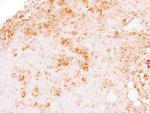 IL-1 alpha Antibody in Immunohistochemistry (Paraffin) (IHC (P))