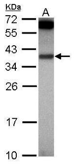 IL-1 alpha Antibody in Western Blot (WB)