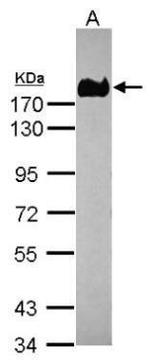 CEA Antibody in Western Blot (WB)